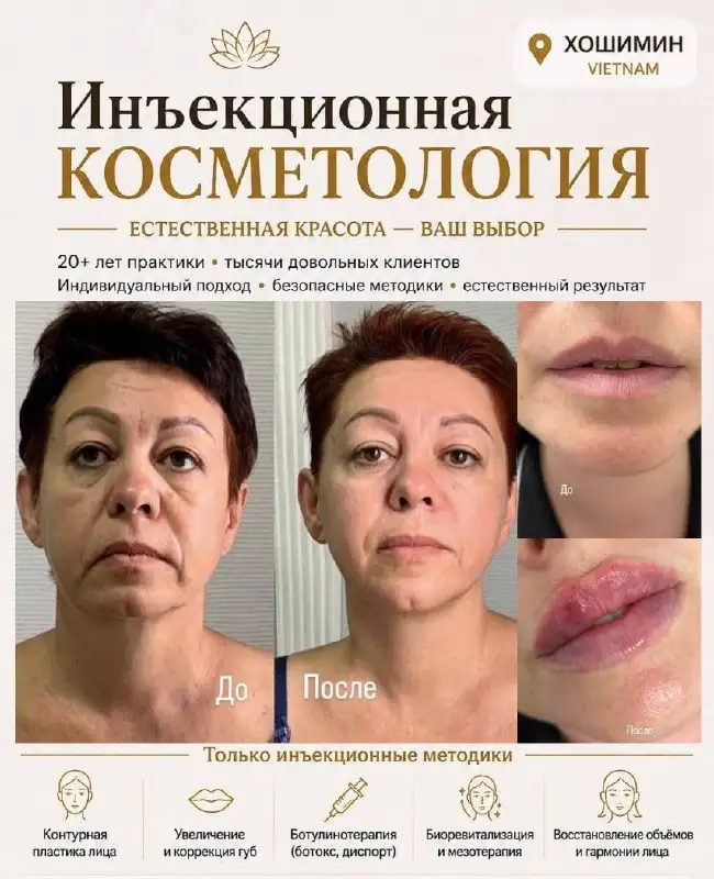 Инъекционная косметология в Хошимине